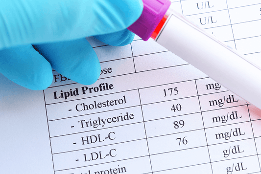 Cholesterol values table